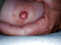 Dreming Breast,In acetous