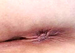 My Asshole